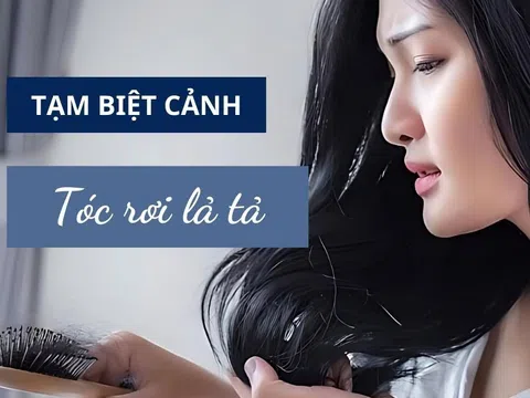 6 giải pháp đơn giản giúp bạn giảm rụng tóc theo mùa hiệu quả