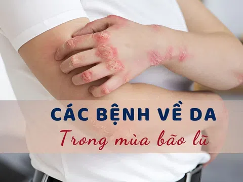 Cảnh báo 4 loại bệnh về da dễ mắc phải trong và sau mùa mưa lũ