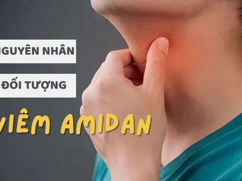 Viêm amidan là gì? Nguyên nhân, triệu chứng, đối tượng thường gặp ở độ tuổi nào?