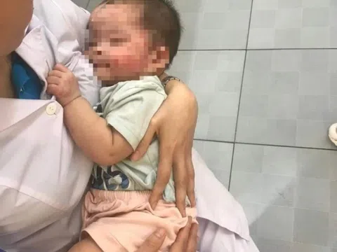 Bé gái 7 tháng tuổi bị bỏ rơi bên đường, muỗi đốt kín mặt