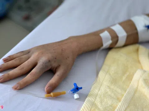 Lý do khiến ngày càng nhiều người Việt phát hiện mắc ung thư