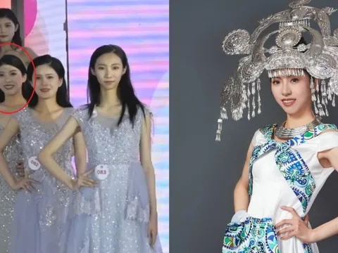 Nhan sắc tân Hoa hậu Thế giới Trung Quốc bị chê