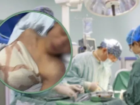 Thẩm mỹ viện lừa chàng trai thiểu năng trí tuệ làm phẫu thuật nâng ngực