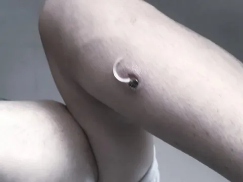 Giun rồng 'đục khoét' cơ thể người đàn ông