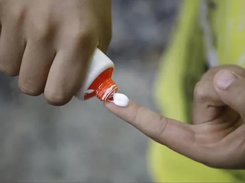 Bộ Y tế đình chỉ lưu hành, thu hồi toàn quốc loại kem bôi da do tên gây hiểu nhầm là thuốc