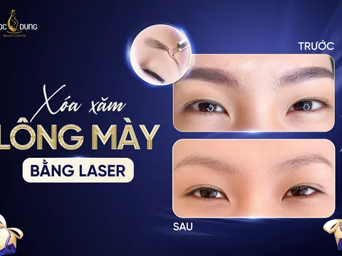 Xóa xăm chân mày: Cách khắc phục mày lỗi nhanh nhất