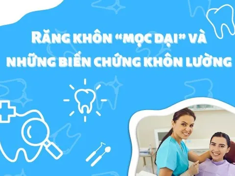 Răng khôn “mọc dại” và những biến chứng khôn lường