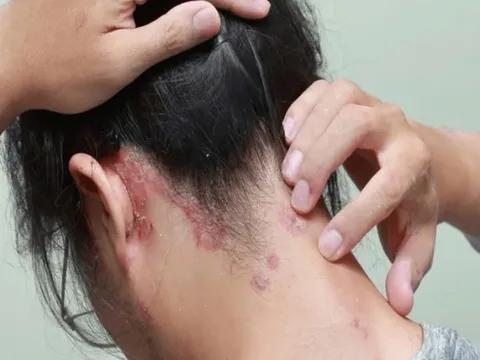 Nguy cơ biến chứng tiêu đường đến từ đâu