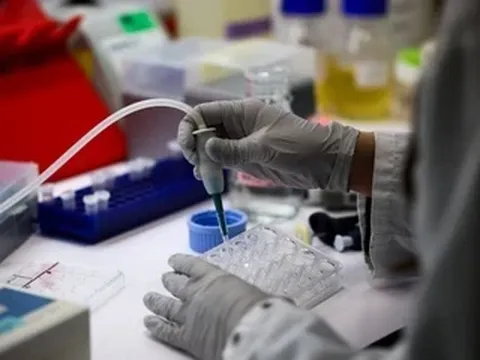 Virus Nipah gây tử vong cao, vì sao chưa có thuốc và vaccine?